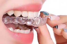 隱形矯正（隱適美、正雅、時(shí)代天使）